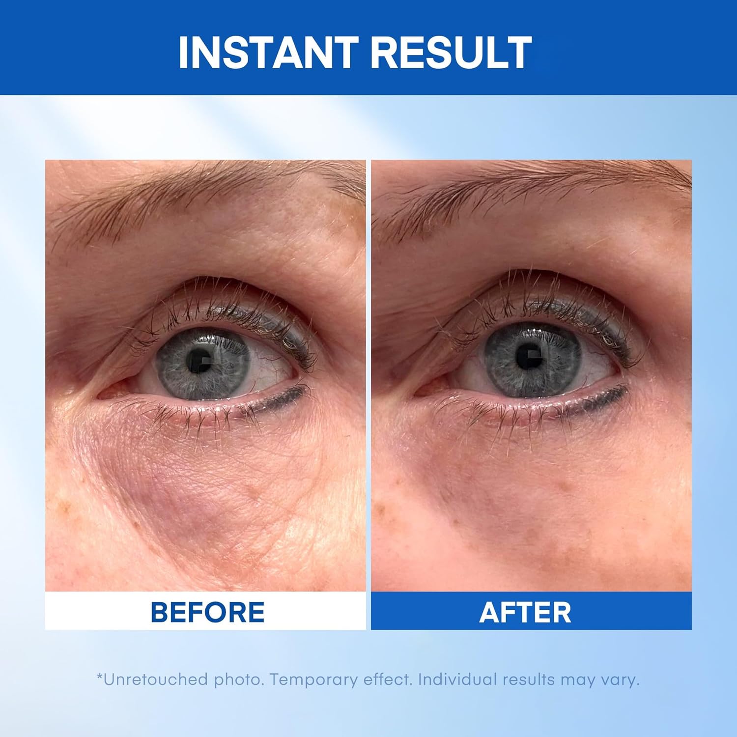 Instant Tightening Eye Serum